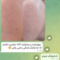 آموزش درما پلنینگ و خدمات پاکسازی و بافت مو