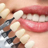 کامپوزیت و لمینت دندان اقساط بدون بهره