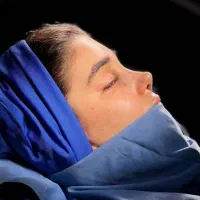 جشنواره جراحی زیبایی بینی
