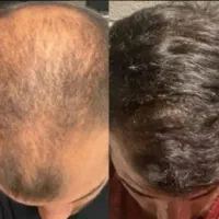 زنده اش کن موهاتو