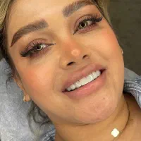 تخفیف کامپوزیت دندانپزشکی به مناسبت عید غدیر
