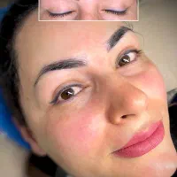 ریموو تاتو  و پیلینگ هالیوودی