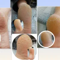 پدیکور وکفسابی تخصصی پا باقیمت مناسب