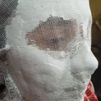 اموزش بند،نخ،وکس آب،درما فیشیال پاکسازی