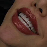 خدمات زیبایی و درمانی با تخفیف ویژه شرایط موجود