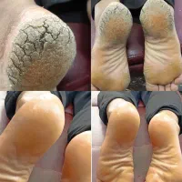 پدیکور فیشال پروتز مو روشن‌سازی تیرگی های پوست