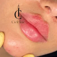 تخفیف ویژه خدمات زیبایی کلینیک زیبایی مدت محدود