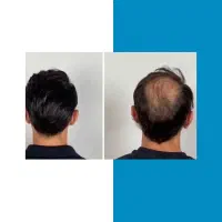 سلامتی موهات به دست بیار