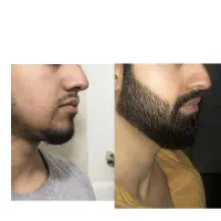 روغن و ... بذار کنار متد۲۰ روزه تضمینی آوردم برات