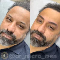 میکروبلیدینگ ابرو آقایان