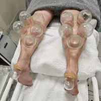 طب سنتی می‌کند آنچه داروها نمی‌توانند(ماساژ، حجامت