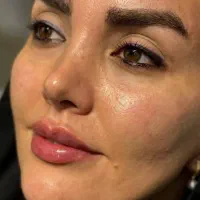 تزریق تخصصی وتضمینی ژل بوتاکس.فیلرصورت وبادی فیشال