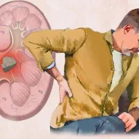 سنگ شکنی و پاکسازی کلیه کاملا گیاهی