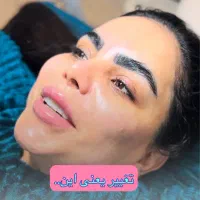 خدمات فیشیال،مزونیدلینگ،پلکسر،مزوتراپی