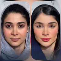 آف۴۰٪ جوانسازی مزو ژل جالپرو Drپوست غبغب بینی ابرو