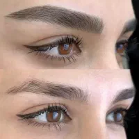 میکروبلیدینگ/میکروپیگمنتیشن/فیبروز/ریمو تتو ابرو