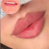 جشنواره تزریقات زیبایی