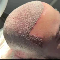 کاشتمو رضایی  شرایط ویژه اقساط به روشMicroFUE++