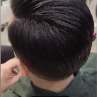 چسب پروتز