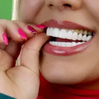لمینت متحرک دندان