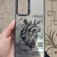 قاب موبایل