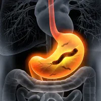 اموزش رایگان درمان ناراحتی معده