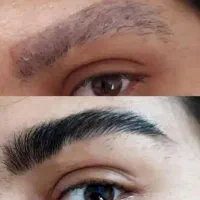 چرا تتو فیبروز هاشور وقتی طبیعی میشه