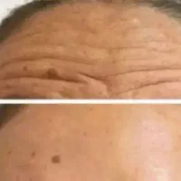 حس جوانی پوست تنها با یکبار فقط