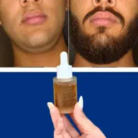 با این محلول ریش و موت رو تقویت کن