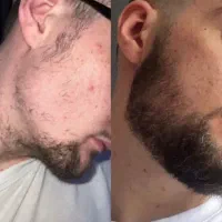 ریشاتو با ما پرپشت کن