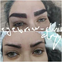 کلینیک مجوزدار کاشت ابرو در قم