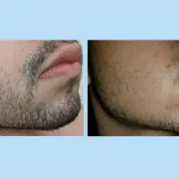مرد شو|آرایشی، بهداشتی، درمانی|تویسرکان, |دیوار