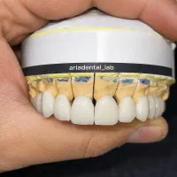 تخفیف ویژه آموزش دنداسازی