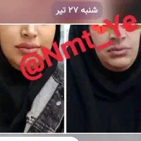 افزایش و کاهش وزن بدون عوارض.شروع قیمت از ۴۰۰
