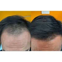 این روش همه رو غافلگیر کرده