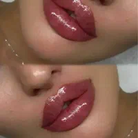 تزریق ژل و بوتاکس ومزو و فیشیال تخصصی پوست