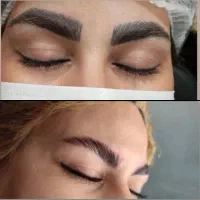 حذف تتو ابرو و بدن ۵۵۰