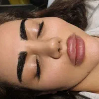 تزریق انواع فیلر بوتاکس مزو مزوژل prpساکشن  آموزش