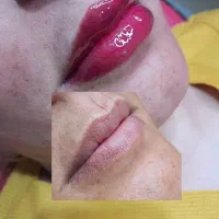 معجزه ی میکرو و کاور تاتو قدیمی