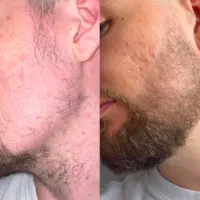 استایلتو بساز