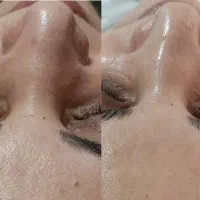 فیشال دست رایگان