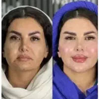 آخرین روز جشنواره تا فردا)فقط1/950با20خدمات رایگان