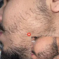 دیگه غصه نداشن ریش وسیبیل نداشته باش