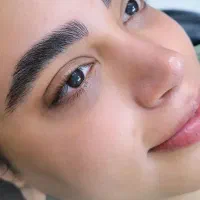 میکروبلیدینگ فیبروز تتو