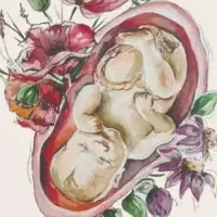 مطب مامایی و زنان