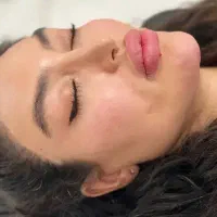 مرکز تخصصی ژل و بوتاکس بادی قیمت استثنایی