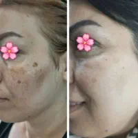 کرم بیوممتیک