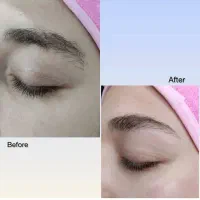 اصلاح خیس صورت
