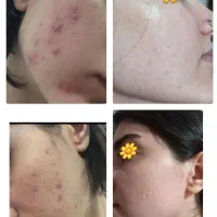 پاکسازی صورت