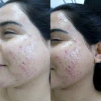 فیشال و کربوکسی عیدانه با تخفیف ویژه